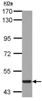 Western blot - Anti-CYP26A1 antibody (AB151968), expandable thumbnail