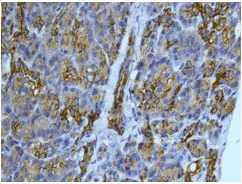 Immunohistochemistry (Formalin/PFA-fixed paraffin-embedded sections) - Anti-CYP26A1 antibody [EPR11841] (AB172474)
