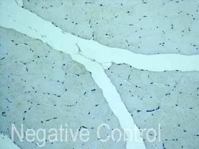 Immunohistochemistry (Formalin/PFA-fixed paraffin-embedded sections) - Anti-CYP26A1 antibody [EPR11841] (AB172474)