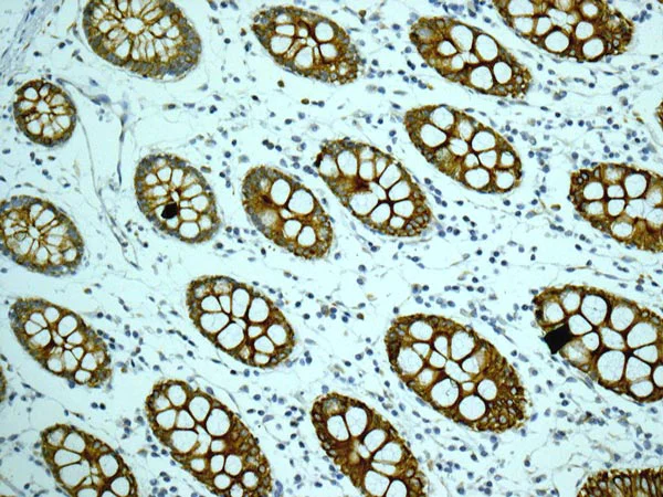 Immunohistochemistry (Formalin/PFA-fixed paraffin-embedded sections) - Anti-CYP26A1 antibody [EPR11841] (AB172474)