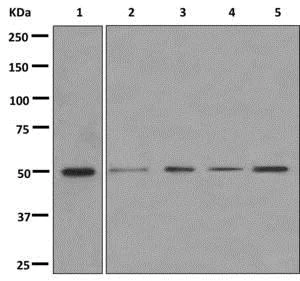 Western blot - Anti-CYP26A1 antibody [EPR11841] (AB172474)