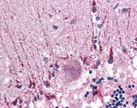 Immunohistochemistry (Formalin/PFA-fixed paraffin-embedded sections) - Anti-Cyp26B1 antibody (AB113236)