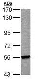 Western blot - Anti-Cyp26B1 antibody (AB113236)