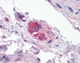 Immunohistochemistry (Formalin/PFA-fixed paraffin-embedded sections) - Anti-Cyp26B1 antibody (AB113640)