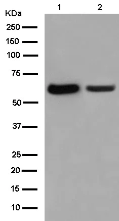 Western blot - Anti-Cyp26B1 antibody [EPR13182] (AB182162)