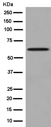 Western blot - Anti-Cyp26B1 antibody [EPR13182] - BSA and Azide free (AB250604)