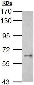 Western blot - Anti-CYP26C1 antibody - N-terminal (AB211115), expandable thumbnail