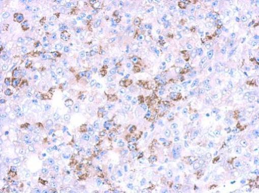 Immunohistochemistry (Formalin/PFA-fixed paraffin-embedded sections) - Anti-CYP27A1 antibody (AB227248)