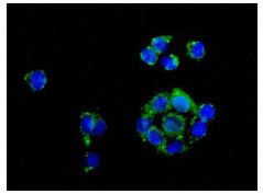Immunocytochemistry/ Immunofluorescence - Anti-CYP27A1 antibody [EPR7529] (AB126785), expandable thumbnail