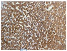 Immunohistochemistry (Formalin/PFA-fixed paraffin-embedded sections) - Anti-CYP27A1 antibody [EPR7529] (AB126785), expandable thumbnail