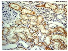 Immunohistochemistry (Formalin/PFA-fixed paraffin-embedded sections) - Anti-CYP27A1 antibody [EPR7529] (AB126785), expandable thumbnail