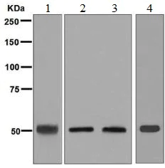 Western blot - Anti-CYP27A1 antibody [EPR7529] (AB126785)