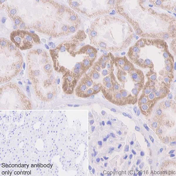 Immunohistochemistry (Formalin/PFA-fixed paraffin-embedded sections) - Anti-CYP27B1 antibody [EPR20271] (AB206655)