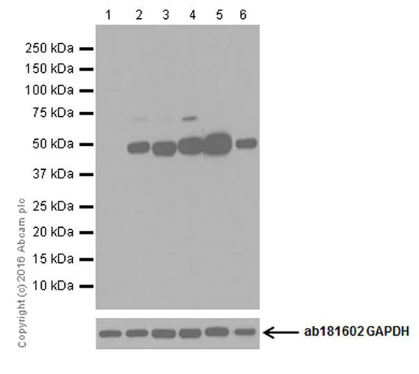Western blot - Anti-CYP27B1 antibody [EPR20271] (AB206655)