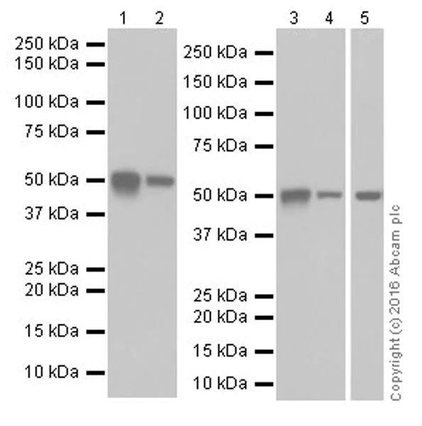 Western blot - Anti-CYP27B1 antibody [EPR20271] (AB206655)
