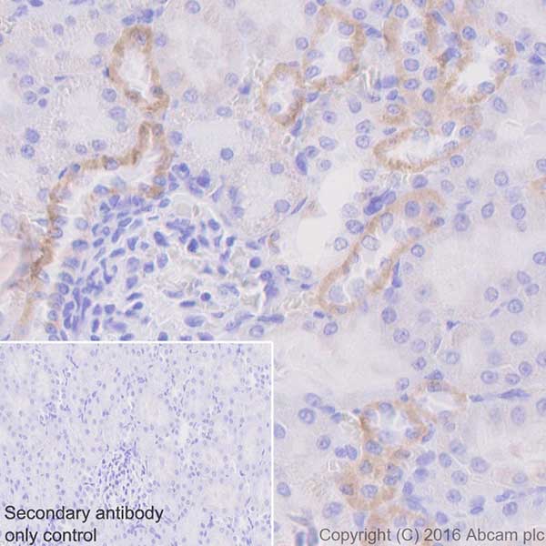 Immunohistochemistry (Formalin/PFA-fixed paraffin-embedded sections) - Anti-CYP27B1 antibody [EPR20271] - BSA and Azide free (AB238978), expandable thumbnail