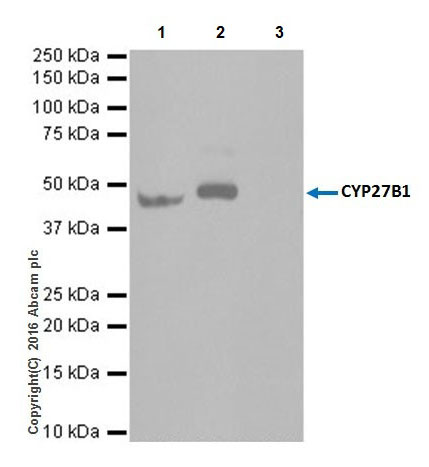 Immunoprecipitation - Anti-CYP27B1 antibody [EPR20271] - BSA and Azide free (AB238978), expandable thumbnail