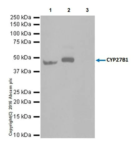 Immunoprecipitation - Anti-CYP27B1 antibody [EPR20271] - BSA and Azide free (AB238978)