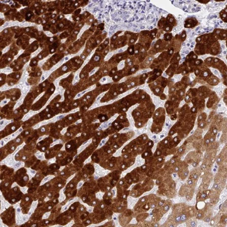 Immunohistochemistry (Formalin/PFA-fixed paraffin-embedded sections) - Anti-CYP2A13 antibody (AB223785)