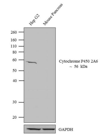 Western blot - Anti-CYP2A6 antibody (AB3570)