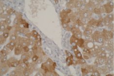 Immunohistochemistry (Formalin/PFA-fixed paraffin-embedded sections) - Anti-CYP2A6 antibody [F16 P2 D8] (AB56069)