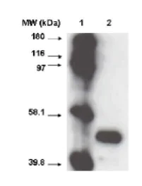 Western blot - Anti-CYP2A6 antibody [F16 P2 D8] (AB56069)