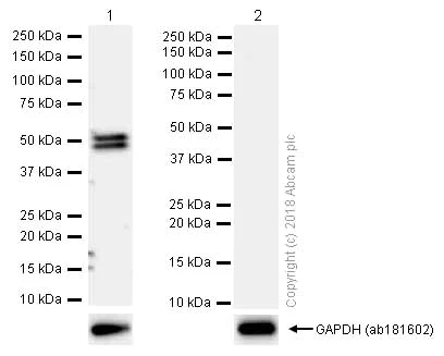 Western blot - Anti-CYP2C19 antibody [EPR6576] (AB137015)