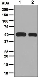 Western blot - Anti-CYP2C19 antibody [EPR6576] (AB137015)