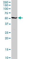 Western blot - Anti-CYP2C8 antibody (AB103547), expandable thumbnail