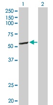 Western blot - Anti-CYP2C8 antibody (AB103547), expandable thumbnail