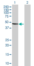 Western blot - Anti-CYP2C8 antibody (AB88904)