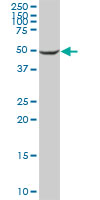 Western blot - Anti-CYP2C8 antibody (AB88904)
