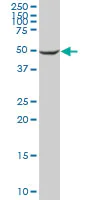 Western blot - Anti-CYP2C8 antibody (AB88904)