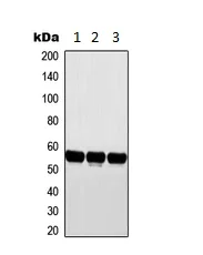 Western blot - Anti-CYP2D6 antibody - C-terminal (AB230472)