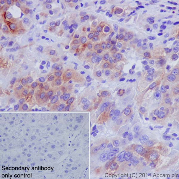 Immunohistochemistry (Formalin/PFA-fixed paraffin-embedded sections) - Anti-CYP2D6 antibody [EPR17868] (AB185625)