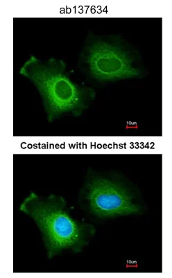 Immunocytochemistry/ Immunofluorescence - Anti-CYP2R1 antibody (AB137634)