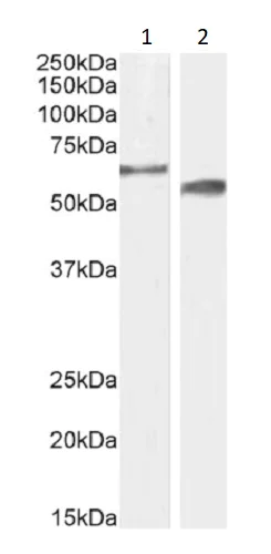 Western blot - Anti-CYP2R1 antibody (AB239217)