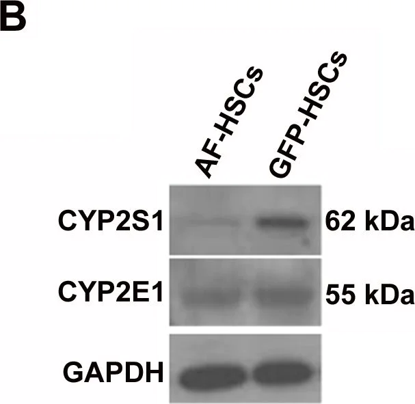 Western blot - Anti-CYP2S1 antibody (AB69650)