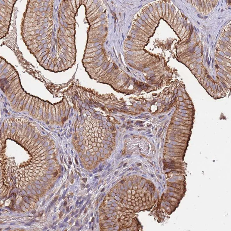 Immunohistochemistry (Formalin/PFA-fixed paraffin-embedded sections) - Anti-CYP2U1 antibody (AB252975)