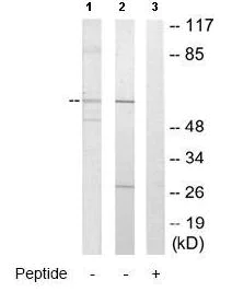 Western blot - Anti-CYP2U1 antibody (AB65128)