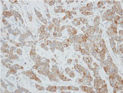 Immunohistochemistry (Formalin/PFA-fixed paraffin-embedded sections) - Anti-CYP3A43 antibody (AB155029)