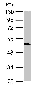 Western blot - Anti-CYP3A43 antibody (AB155029), expandable thumbnail