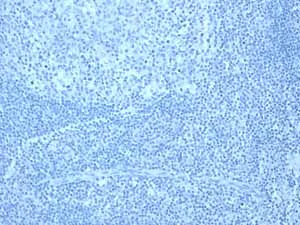 Immunohistochemistry (Formalin/PFA-fixed paraffin-embedded sections) - Anti-CYP3A5 antibody [EPR4396] (AB108624)