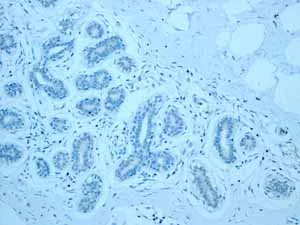 Immunohistochemistry (Formalin/PFA-fixed paraffin-embedded sections) - Anti-CYP3A5 antibody [EPR4396] - BSA and Azide free (AB246337)