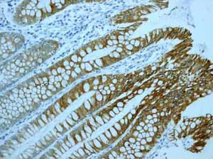 Immunohistochemistry (Formalin/PFA-fixed paraffin-embedded sections) - Anti-CYP3A5 antibody [EPR4396] - BSA and Azide free (AB246337)