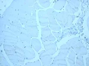 Immunohistochemistry (Formalin/PFA-fixed paraffin-embedded sections) - Anti-CYP3A5 antibody [EPR4396] - BSA and Azide free (AB246337)