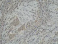 Immunohistochemistry (Formalin/PFA-fixed paraffin-embedded sections) - Anti-CYP3A5 antibody [F18 P3 B6] (AB56076)