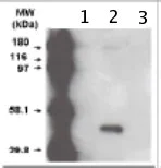 Western blot - Anti-CYP3A5 antibody [F18 P3 B6] (AB56076)