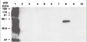 Western blot - Anti-CYP3A5 antibody [F18 P3 B6] (AB56076)
