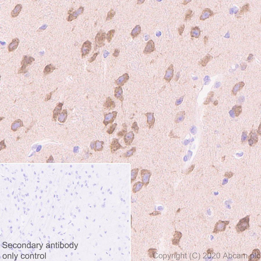 Immunohistochemistry (Formalin/PFA-fixed paraffin-embedded sections) - Anti-CYP46A1 antibody [1A7] (AB244241), expandable thumbnail